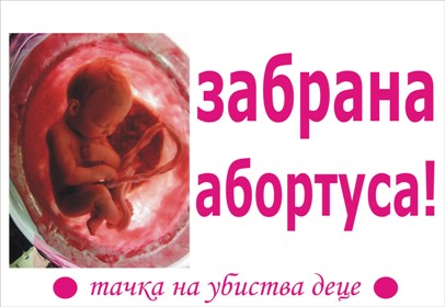Baner zabrane abortusa 2
